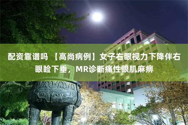 配资靠谱吗 【高尚病例】女子右眼视力下降伴右眼睑下垂，MR诊断痛性眼肌麻痹